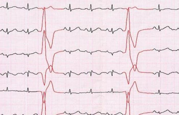 14 علامة غير متوقعة على احتمال الإصابة بسرطان الرئة